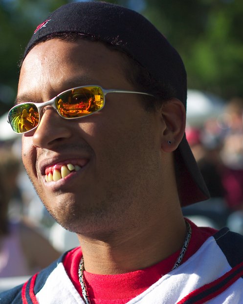 Charles with fake teeth